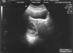 Pregnancy Ultrasound Scans Cork - Professor Barry OReilly
