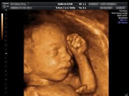 Private Pregnancy Scans Cork - Ultrasound Baby Scans | Dr 